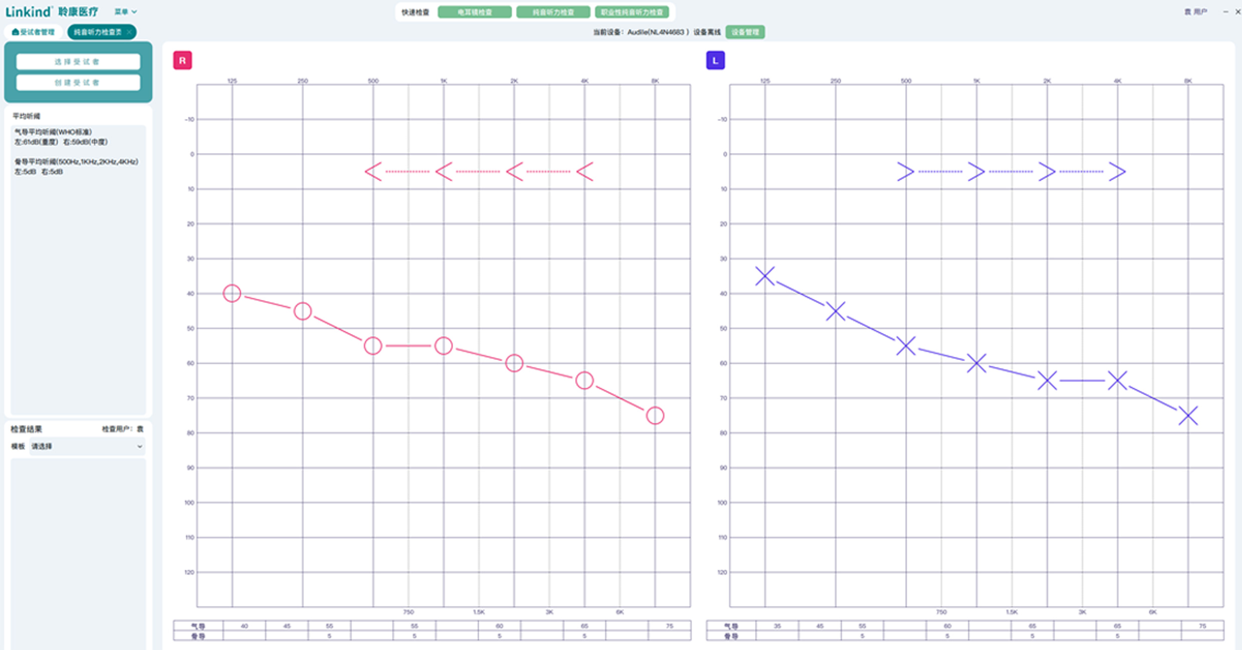 聆康纯音听力计LK-227标准版A(图1)