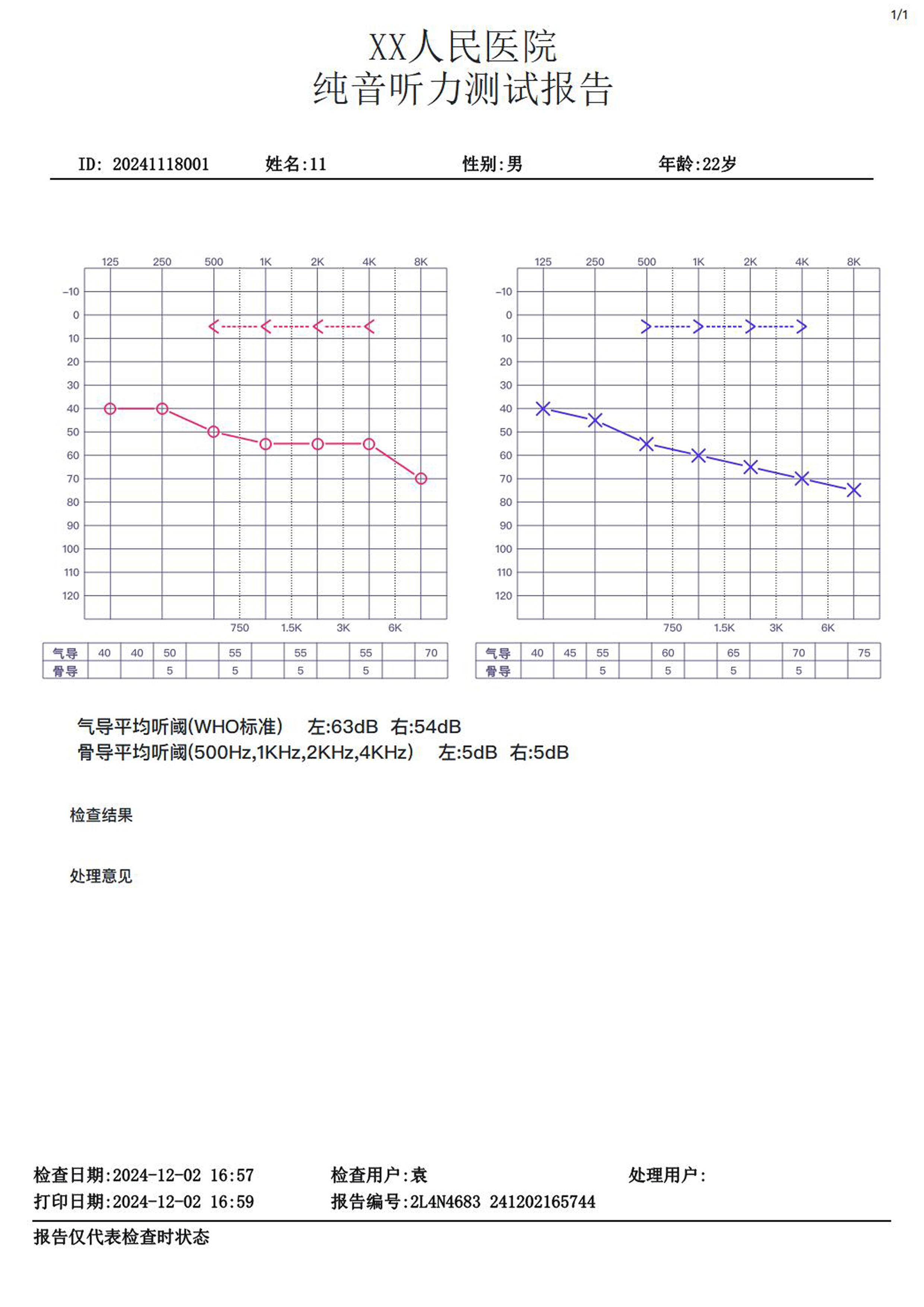 聆康纯音听力计LK-227升级版(图2)