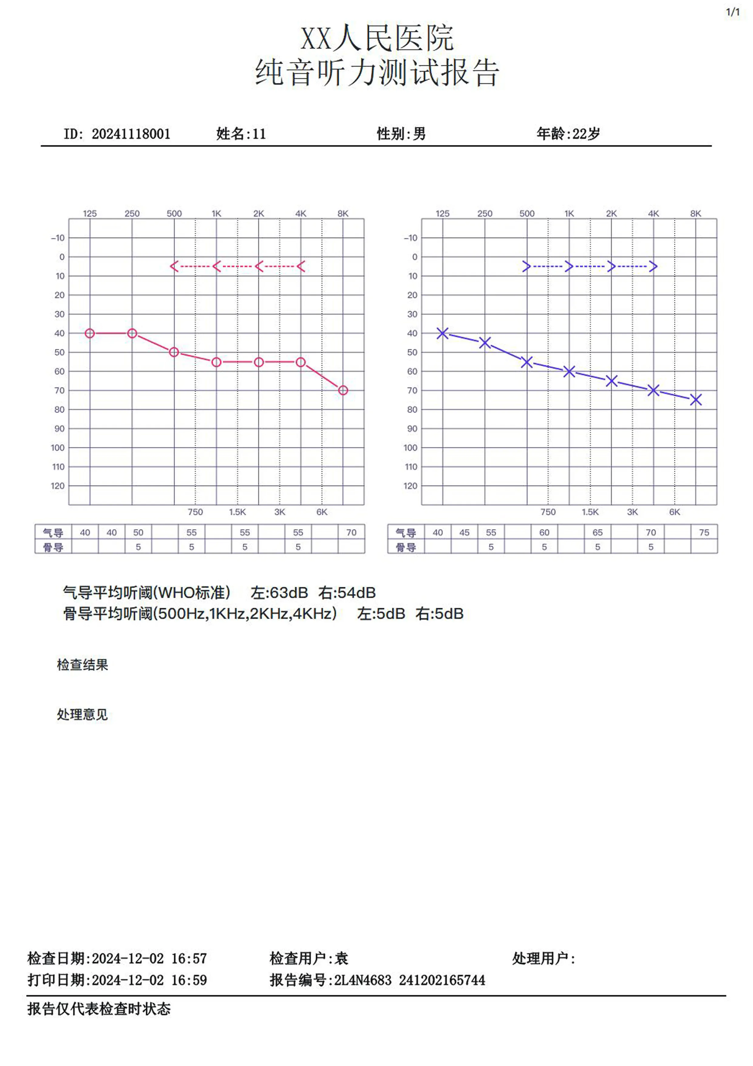 聆康纯音听力计LK-225升级版(图2)